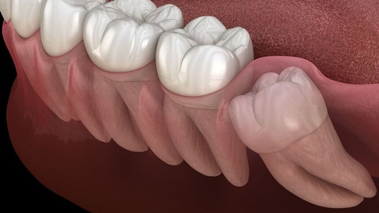 Yirmilik Dişlerin Şaşırtan Faydası: Kalp Kasını Onaran Hücre