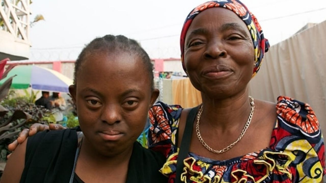 Siyahi Down Sendromlu Bireyler Neden Daha Az Görünüyor?