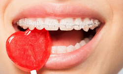 Diş Sağlığı İçin Tüketilmemesi Gereken Besinler
