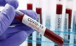 ABD’de Haftalık Covid-19 Ölümleri 300’ü Aştı