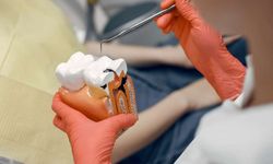 Diş Minesi Nedir? Nasıl Zarar Görür ve Nasıl Güçlendirilir?