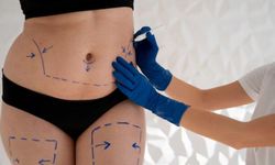 Liposuction Ameliyatı Öncesi Bilinmesi Gerekenler