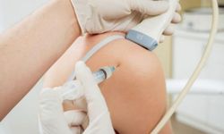 Platelet Rich Plasma (PRP) Tedavisi Nedir? Ne için Uygulanır?