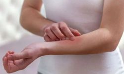 Temre (Temriye) Hastalığı Nedir?