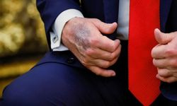 ABD Başkanı Trump’ın Elindeki Morluk Tartışma Yarattı