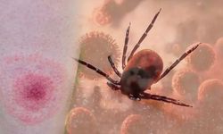 Lyme Hastalığı Nedir, Nasıl Bulaşır? Belirtileri ve Tedavisi