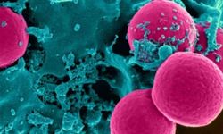 Paraneoplastik Sendrom Nedir? Türleri, Özellikleri ve Tedavisi