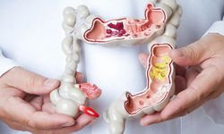 Crohn Hastalığı Nedir? Belirtileri ve Tedavi Yöntemleri