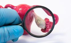 Endometriozis Nedir? Belirtileri ve Tedavi Yöntemleri