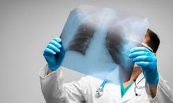 Akciğer Sönmesi (Pnömotoraks) Nedir? Belirtileri ve Tedavisi