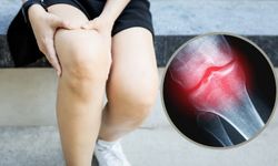 Avasküler Nekroz (Osteonekroz) Nedir? Belirtileri ve Tedavisi