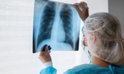 Bronkoskopi Nedir? Neden ve Hangi Durumlarda Uygulanır?