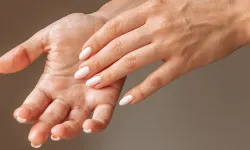 El ve Ayak Terlemesi Nasıl Geçer? El ve Ayak Terlemesini Azaltmanın Etkili Yolları