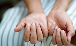 Tırnak Soyulması Neden Olur? Soyulmayı Önlemenin Etkili Yolları