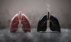 Akciğer Kanserinde Kritik Uyarı: Tütün En Büyük Tehdit