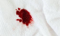 Kan Lekesi Nasıl Temizlenir? Kan Lekesini Çıkarmanın Pratik Yolları