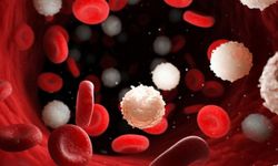 Orak Hücre Anemisi Nedir? Nedenleri, Belirtileri ve Tedavisi