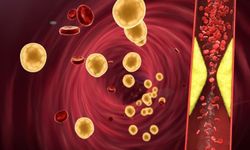 Yüksek Kolesterol Riskine Dikkat: Uzmandan Kalp Sağlığı Uyarısı