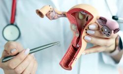 Yumurtalık Kanseri Nedir? Nedenleri, Belirtileri ve Tedavisi