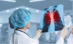 Zatürre Nedir? Belirtileri, Nedenleri ve Tedavisi