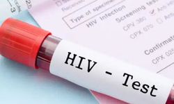 Türkiye’de HIV Artışı için Uzmandan Kritik “Erken Tanı” Uyarısı