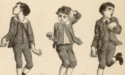 Huntington Hastalığı Nedir? Nedenleri, Belirtileri ve Tedavisi