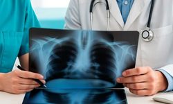 Kartagener Sendromu Nedir? Nedenleri, Belirtileri ve Tedavisi