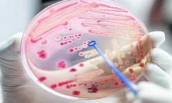 Sepsis Nedir? Nedenleri, Belirtileri ve Tedavisi