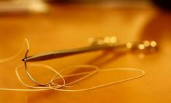 Ameliyat Dikiş İpleri Hayvan Bağırsağından mı Yapılıyor? Katgüt Nedir?