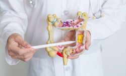 Ülseratif Kolit Atağını Önlemek Mümkün mü? Tetikleyen Faktörler