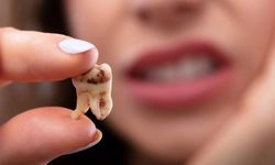 Tedavi Edilmeyen Diş Çürüğü Hangi Hastalıklara Yol Açar?