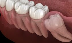 Yirmilik Dişlerin Şaşırtan Faydası: Kalp Kasını Onaran Hücre