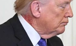 Donald Trump’ın Boynundaki Kızarıklığın Nedeni Belli Oldu