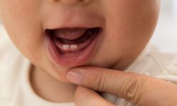 Süt Dişleri Neden Düşer? Kalıcı Dişler Nasıl Yerleşir?