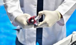 Ankara Balık Hali’nde Av Sezonu Denetimleri Sıklaştırıldı