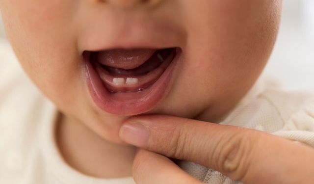 Süt Dişleri Neden Düşer? Kalıcı Dişler Nasıl Yerleşir?