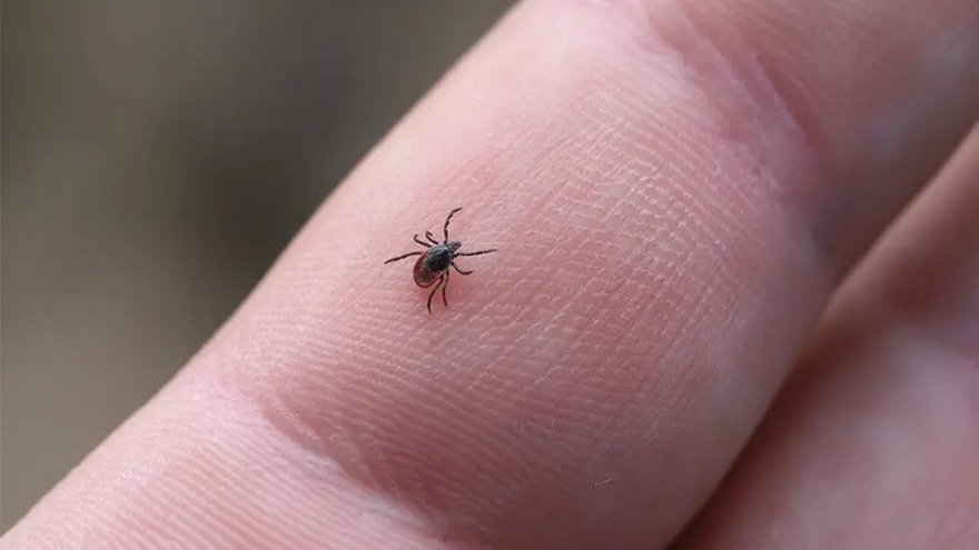 Kene Isırması Nedir Belirtileri Ve Tedavi Süreci Nasıldır 3