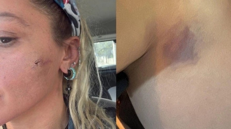 Oyuncu Yıldız Asyalı, Eşinden Şiddet Gördüğünü Açıkladı 2