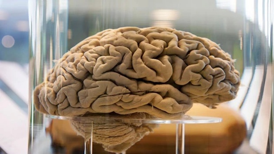 Öğrenmek Beyni Gerçekten Büyütüyor Mu 2